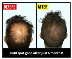 TruVarin Customers Reviews